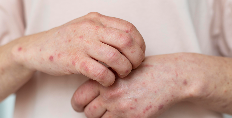 Importance of Parental Counselling